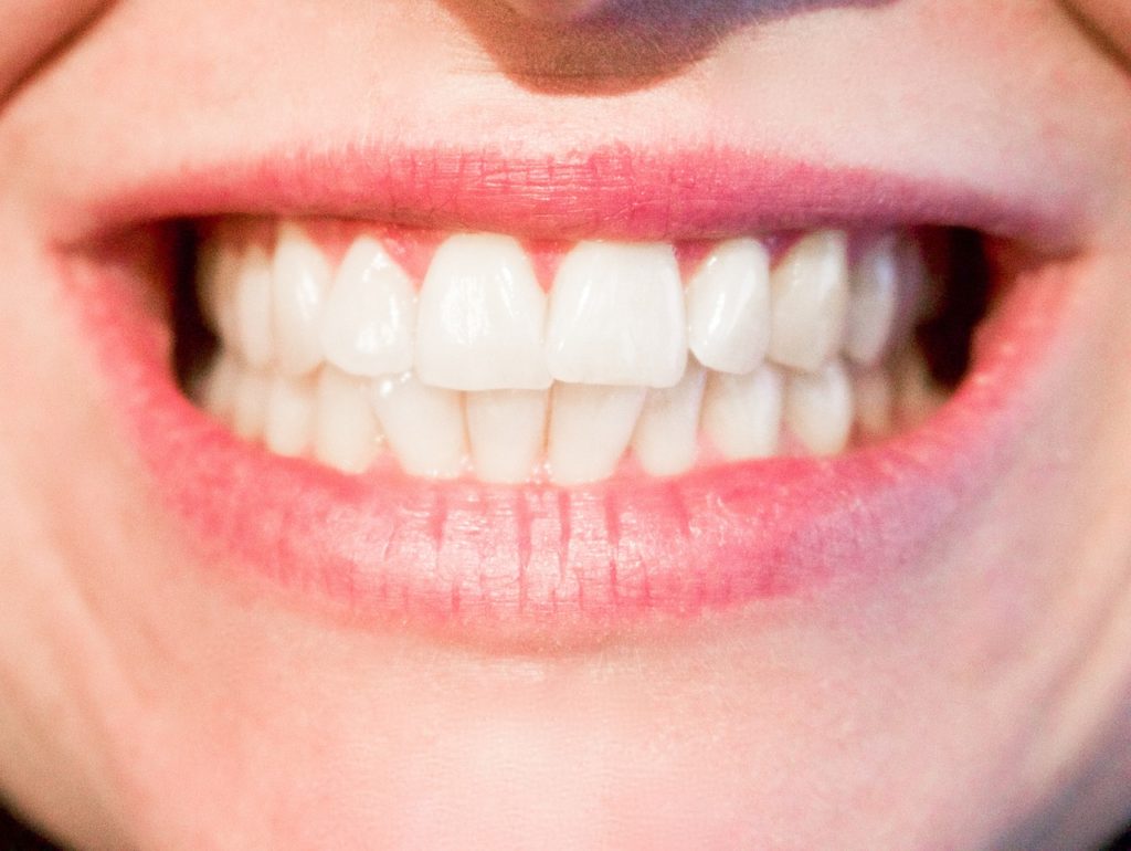 teeth-1652976_1280 (1)